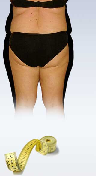 BodyForm4u: Vorher und nachher